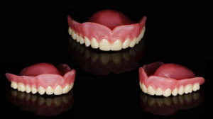 prothèse complète assemblée-impression 3D