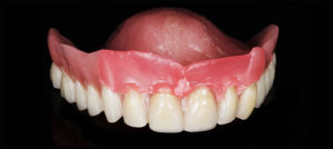 mise en place de la cire-Impression 3D