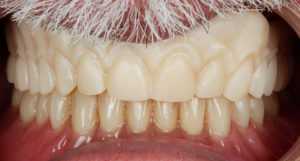 essayages et réglages de la maquette imprimée-impression 3D