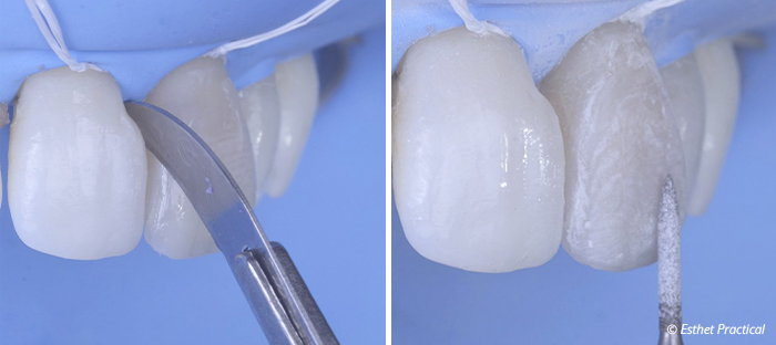 fig17-toledano-esthetique