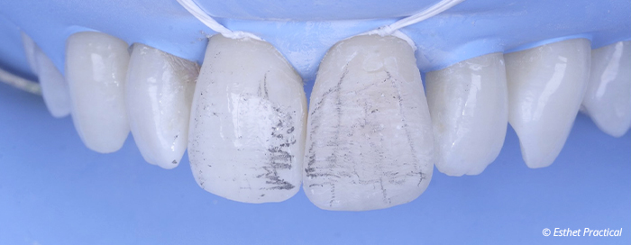 fig18-toledano-esthetique