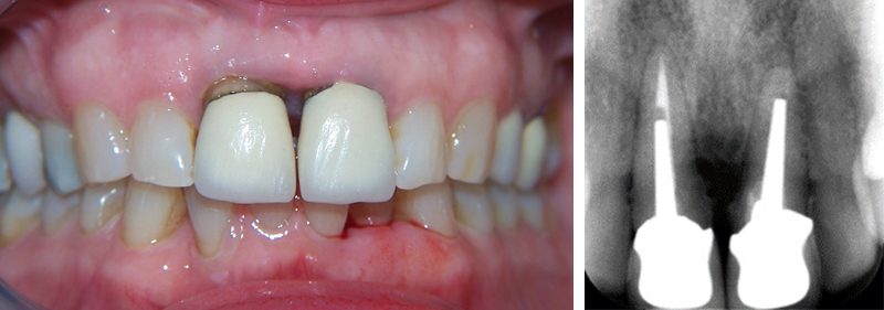 fig-01-article-Jonathan-Amar-extraction
