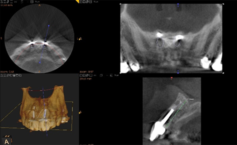 fig-02-article-Jonathan-Amar-extraction