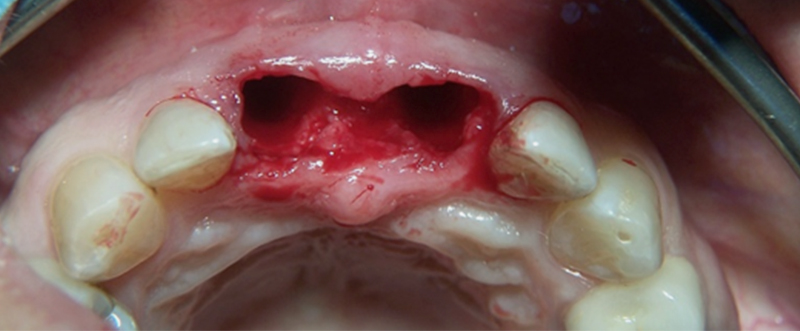 fig-03-article-Jonathan-Amar-extraction