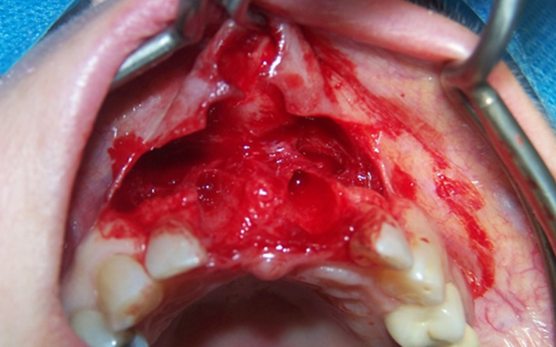 fig-05-article-Jonathan-Amar-extraction