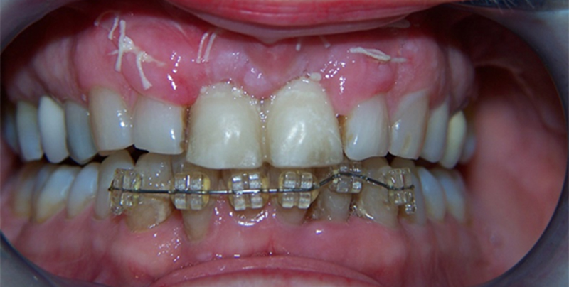 fig-10-article-Jonathan-Amar-extraction