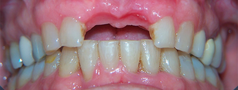 fig-12-article-Jonathan-Amar-extraction