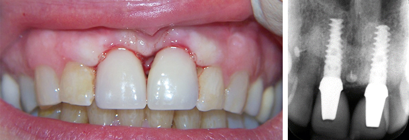 fig-14-article-Jonathan-Amar-extraction