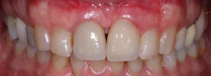 fig-15-article-Jonathan-Amar-extraction