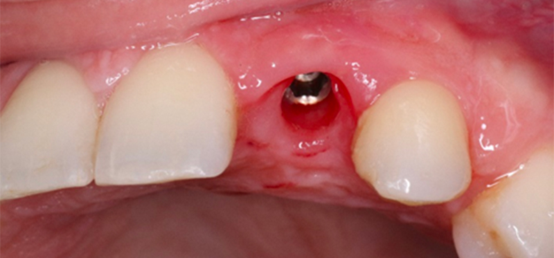 fig-19-article-Jonathan-Amar-extraction
