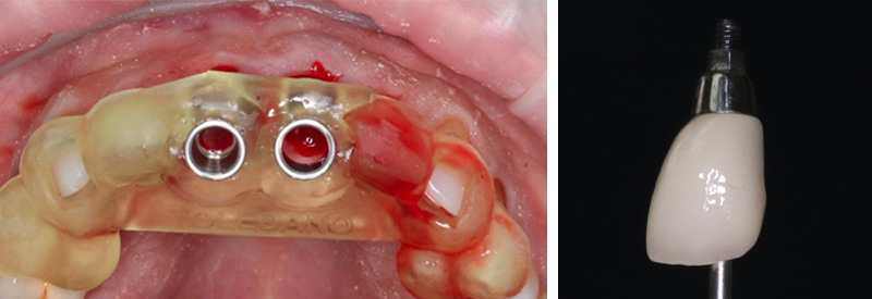 fig-20-article-Jonathan-Amar-extraction