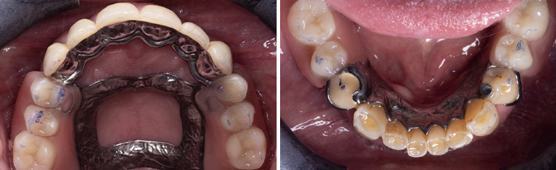 Image-10-Cas-clinique-Alexandre-Billon