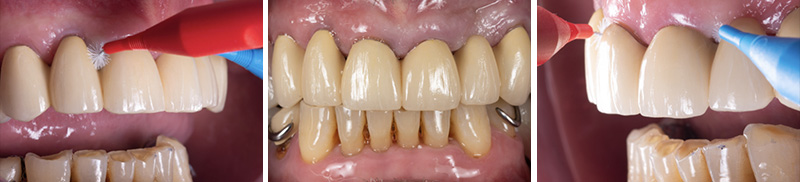 Image-11-Cas-clinique-Alexandre-Billon-Brossettes