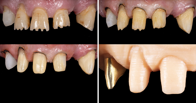 Image-3-Cas-clinique-Alexandre-Billon