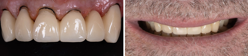 Image-4-Cas-clinique-Alexandre-Billon