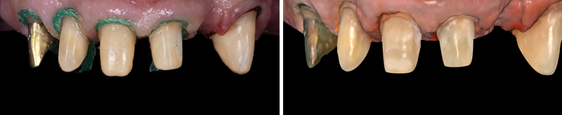 Image-5-Cas-clinique-Alexandre-Billon