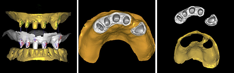 Image-7-Cas-clinique-Alexandre-Billon