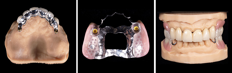 Image-8-Cas-clinique-Alexandre-Billon