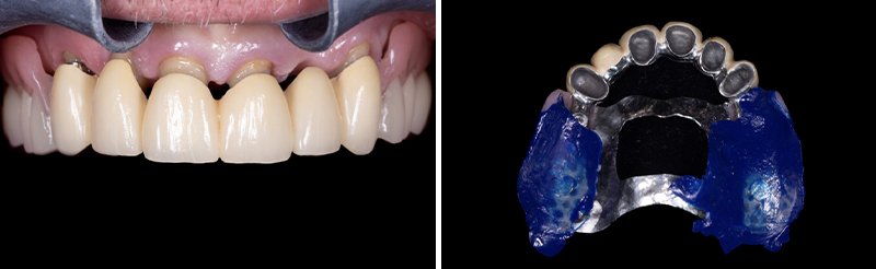 Image-9-Cas-clinique-Alexandre-Billon