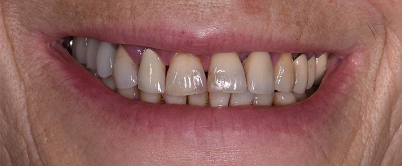 Situation-initiale-Article-3-Video-Linda-Martin-Dexter