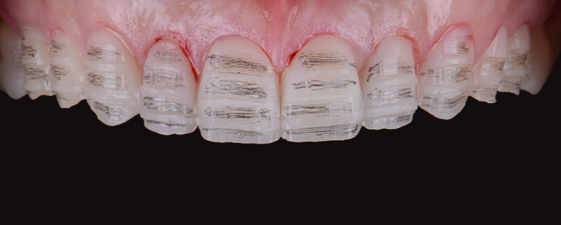 Jauges de preparation