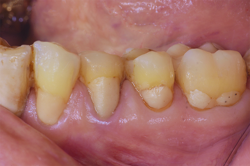 même restauration après 6,5 ans