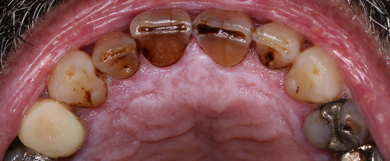 eclaircissement ambulatoire