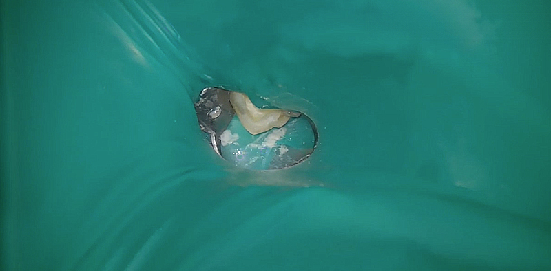 Pose d'une digue avec la technique de la digue percée