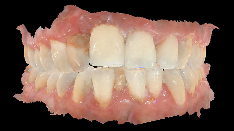 Empreinte optique du cas lors de la première consultation