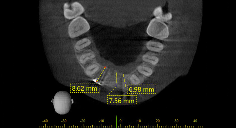 Cone Beam de contrôle