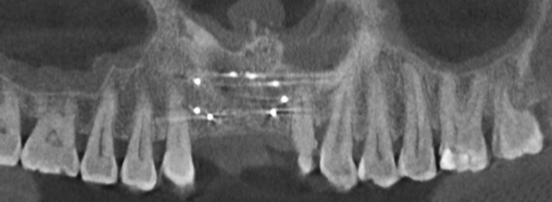 Cone Beam de contrôle