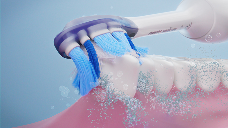 brossage électrique