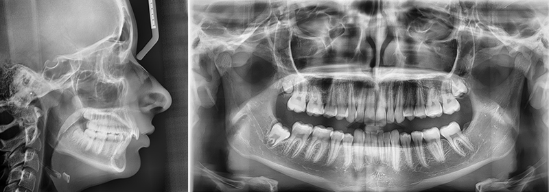 Fig 3 Carriere Motion® téléradiographie