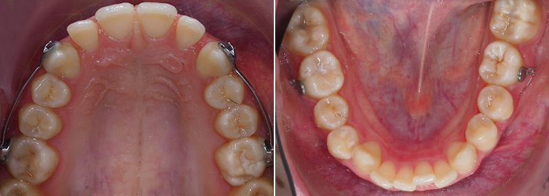 Carriere Motion®, correction de la classe 2