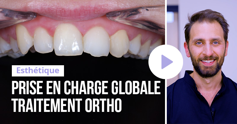 Top 5, article de Ralph Boutros sur l'orthodontique
