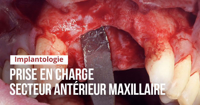 Top 5, clinique sourire de Nicolas Davido