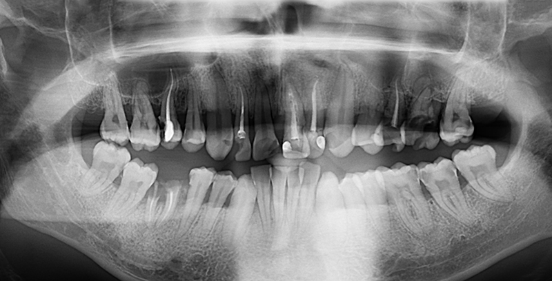 Radio hygiène orale - Sophie Domejean
