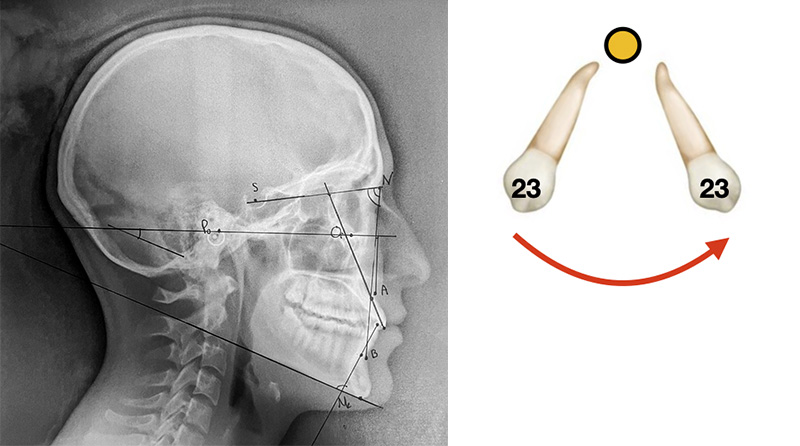 Téléradiographie de profile