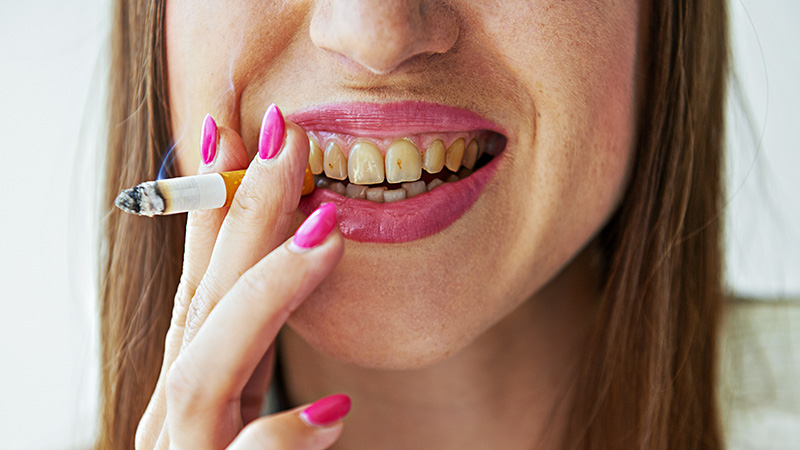 santé bucco-dentaire, tabac