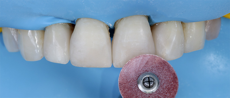 disques de finition et polissage