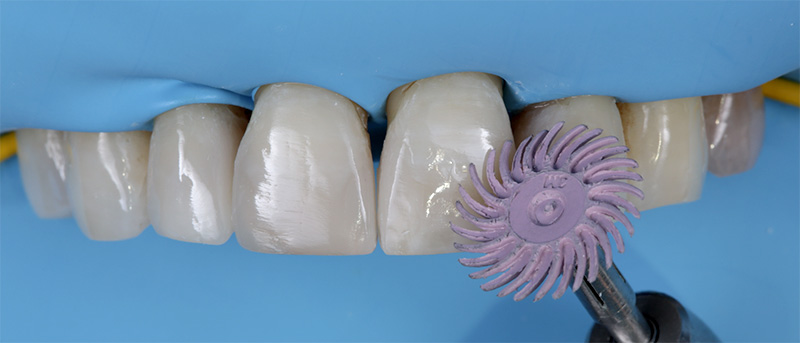 système de polissage