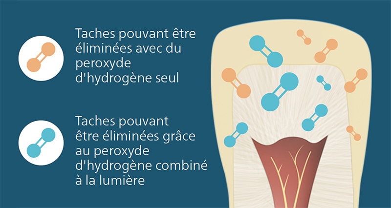 lumière bleue, schéma