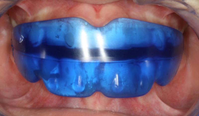 Educateur fonctionnel