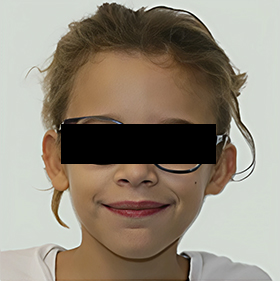 diagnostic en orthodontie, faiblesse respiratoire nasale