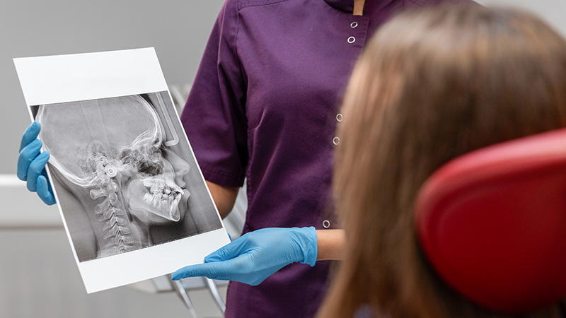 diagnostic squelettique