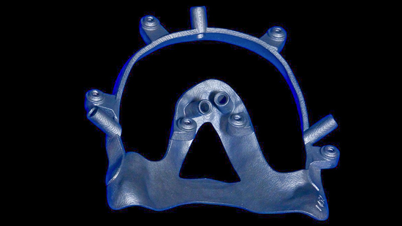 réhabilitation maxillaire, guide base en titane fritté transfixé 