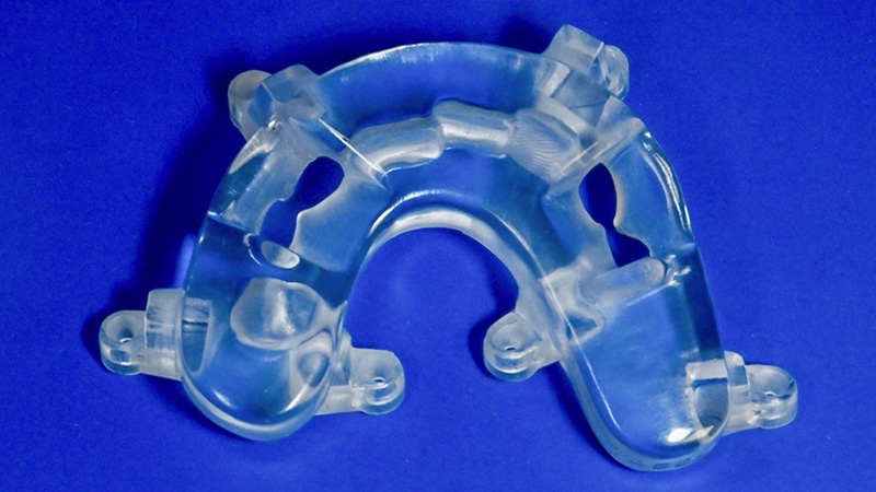 guide de repositionnement occlusal