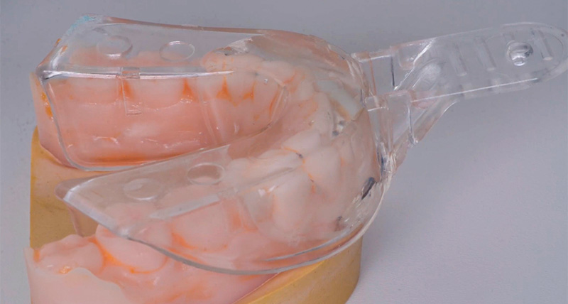 Clé silicone transparente pour composites injectés de 33 à 43