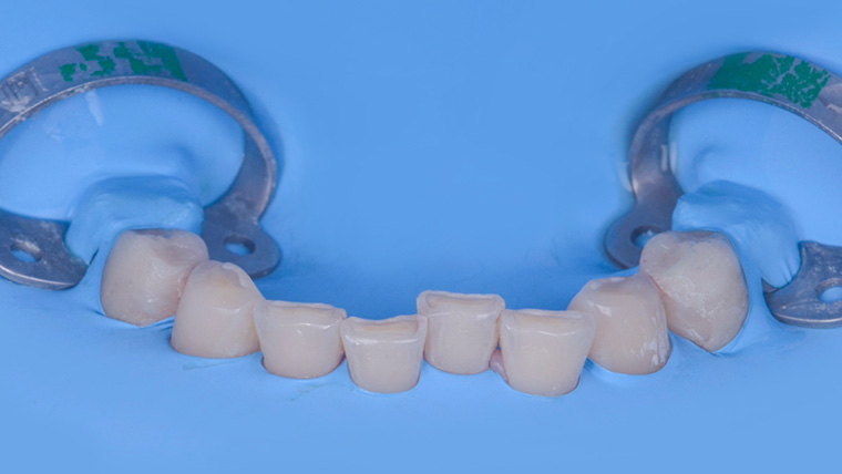 champ opératoire de 34 à 44