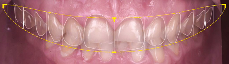 bruxomane - Etat initial